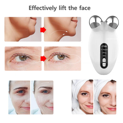 Micro current Face Device Roller™